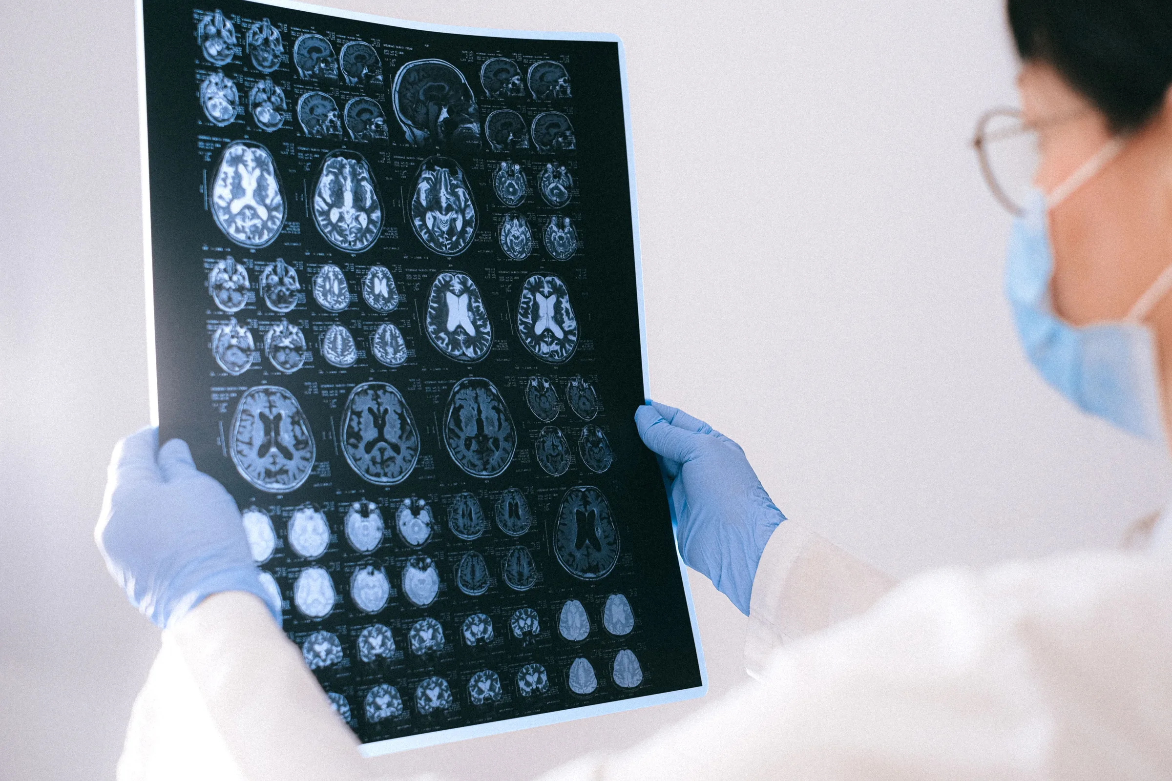 Brain Injuries representation